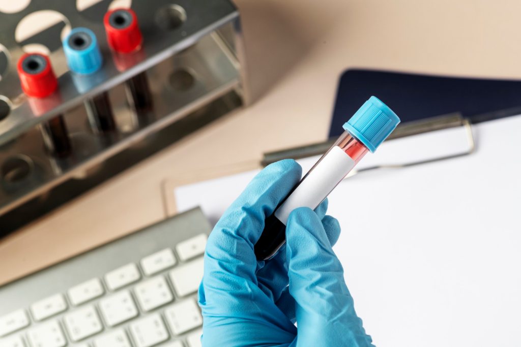 AMH hormone AMH hormone fertility test